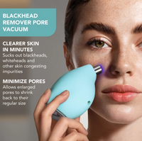 Foreo Kiwi Vacuum Device For Cleaning Pores